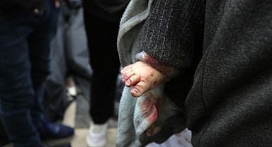 Katil İsrail'in 141 gündür saldırılarını sürdürdüğü Gazze'de can kaybı 29 bin 606'ya yükseldi